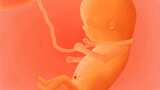 Miscarriage by DiamonDie/foobug^Numedia Cyclops